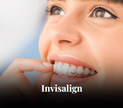 Invislign