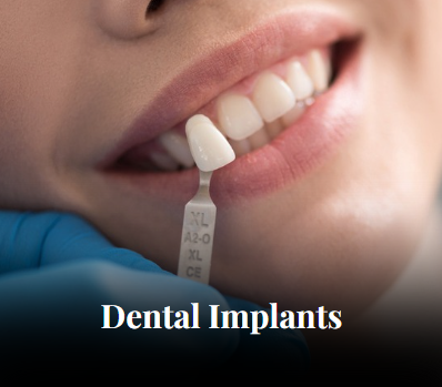 Dental Implants